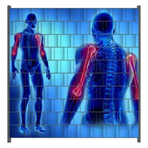 Expressversand Zaunsichtschutz Anatomie Mensch Oberarmknochen Breite 200 cm x Höhe 140 cm